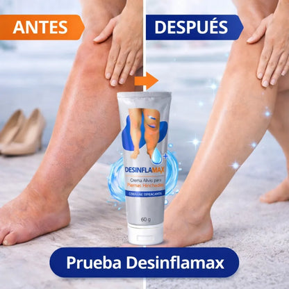 DESINFLAMAX -Piernas hinchadas y doloridas? Esto te va a aliviar en minutos