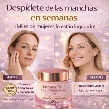 Lumina Piel™  La crema con Ácido Kójico y Niacinamida que ayuda a aclarar manchas y devolver luminosidad a tu piel