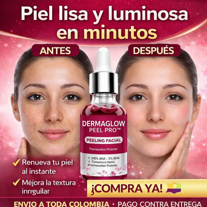 DermaGlow Peel Pro™ – Exfoliación Profunda para Eliminar Acné, Puntos Negros y Manchas