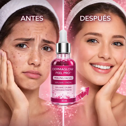 DermaGlow Peel Pro™ – Exfoliación Profunda para Eliminar Acné, Puntos Negros y Manchas