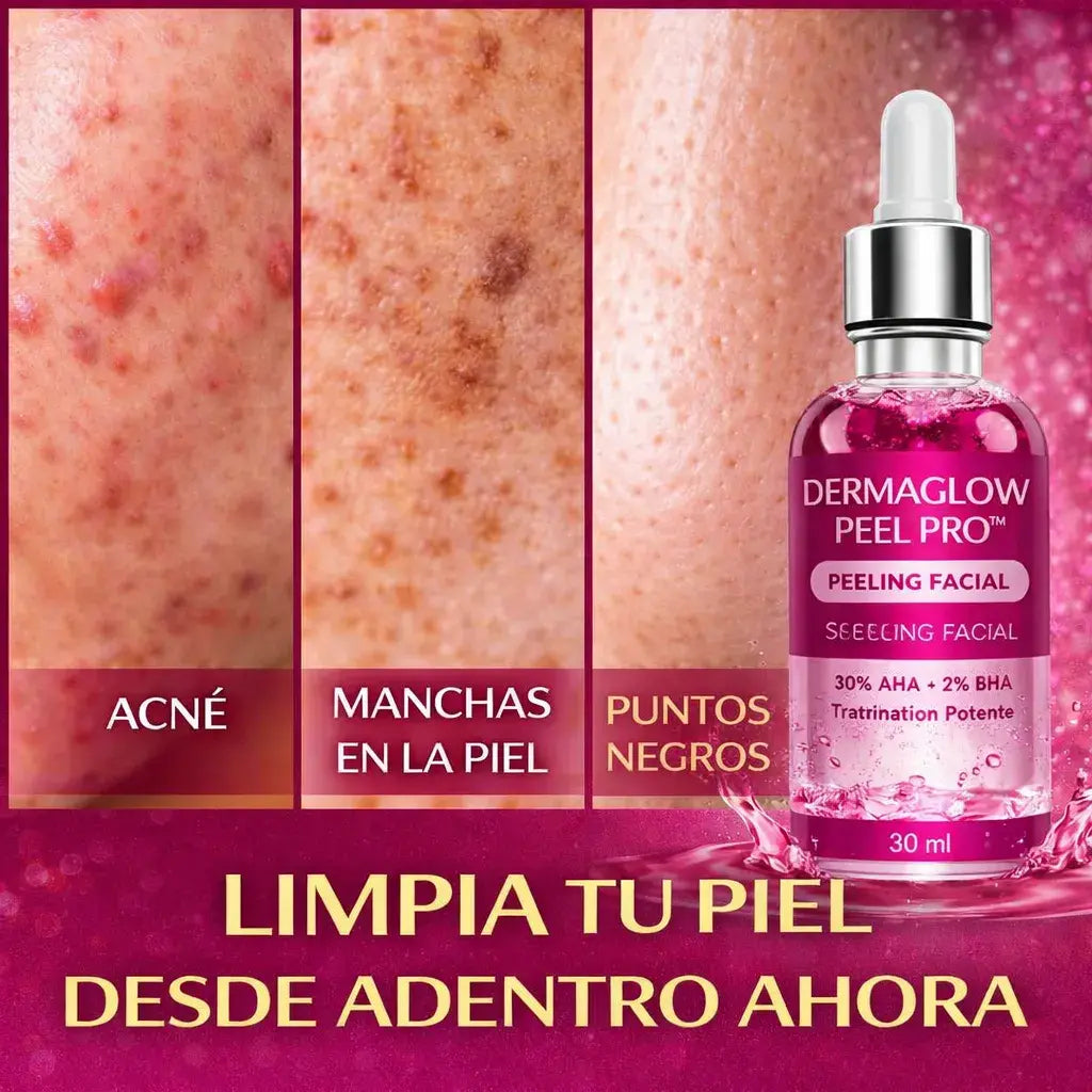 DermaGlow Peel Pro™ – Exfoliación Profunda para Eliminar Acné, Puntos Negros y Manchas