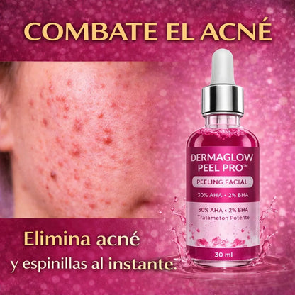 DermaGlow Peel Pro™ – Exfoliación Profunda para Eliminar Acné, Puntos Negros y Manchas