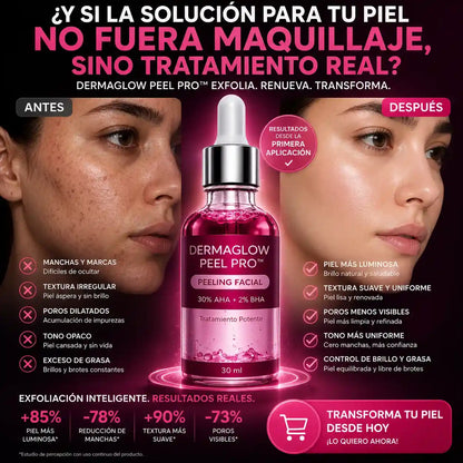 DermaGlow Peel Pro™ – Exfoliación Profunda para Eliminar Acné, Puntos Negros y Manchas