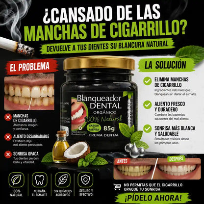 BlancoSonrisa Recupera el blanco natural de tu sonrisa sin tratamientos costosos