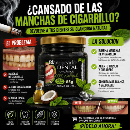 BlancoSonrisa Recupera el blanco natural de tu sonrisa sin tratamientos costosos
