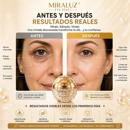 Miraluz™ – Reduce ojeras, arrugas y signos de fatiga en pocos días