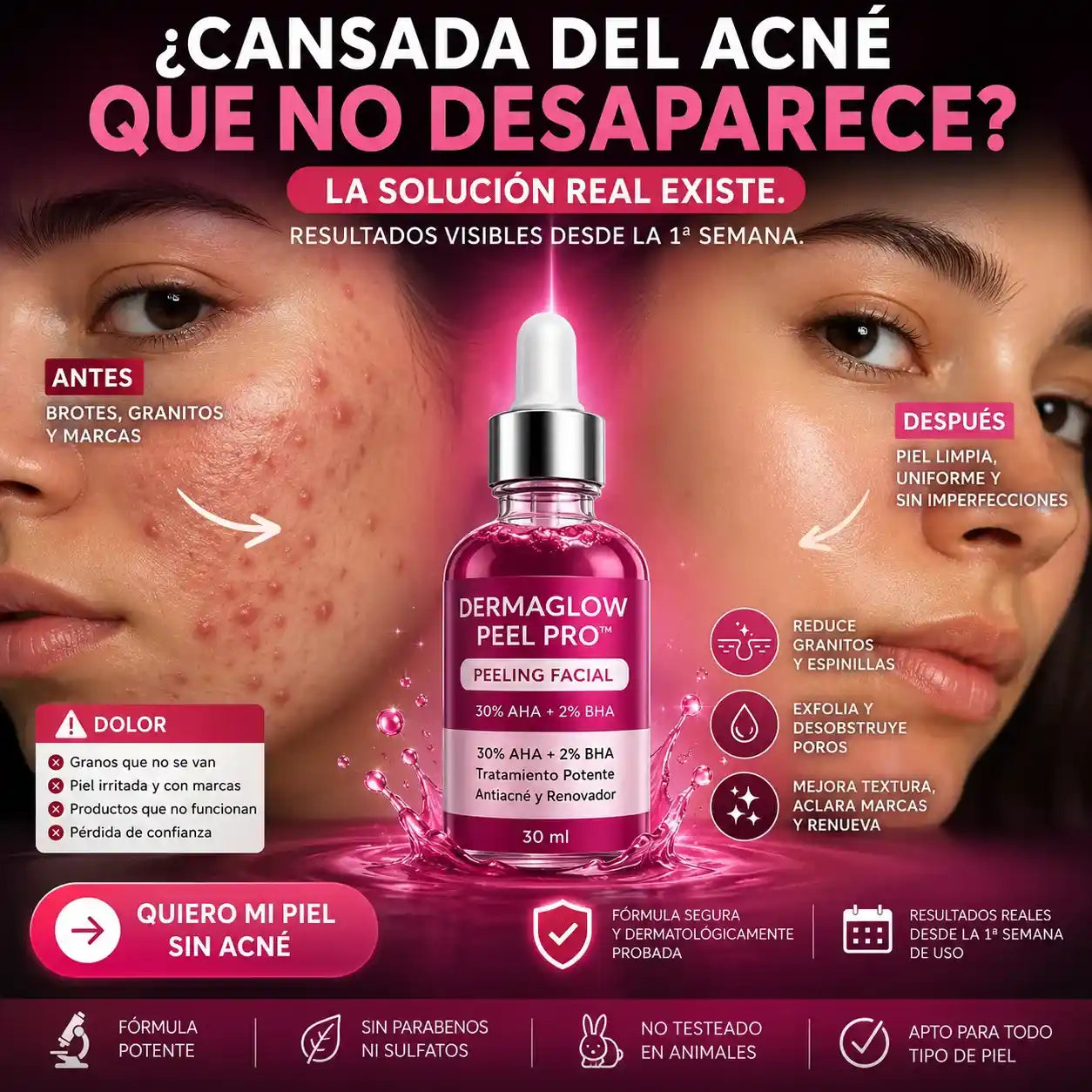 DermaGlow Peel Pro™ – Exfoliación Profunda para Eliminar Acné, Puntos Negros y Manchas