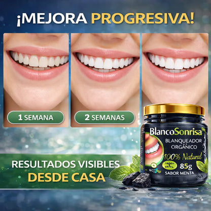 BlancoSonrisa Recupera el blanco natural de tu sonrisa sin tratamientos costosos