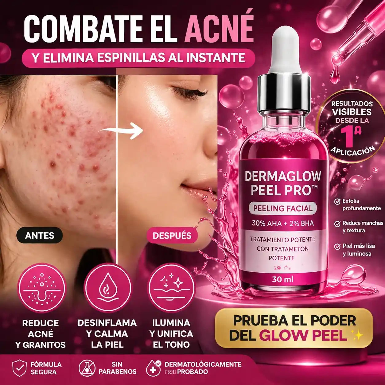 DermaGlow Peel Pro™ – Exfoliación Profunda para Eliminar Acné, Puntos Negros y Manchas