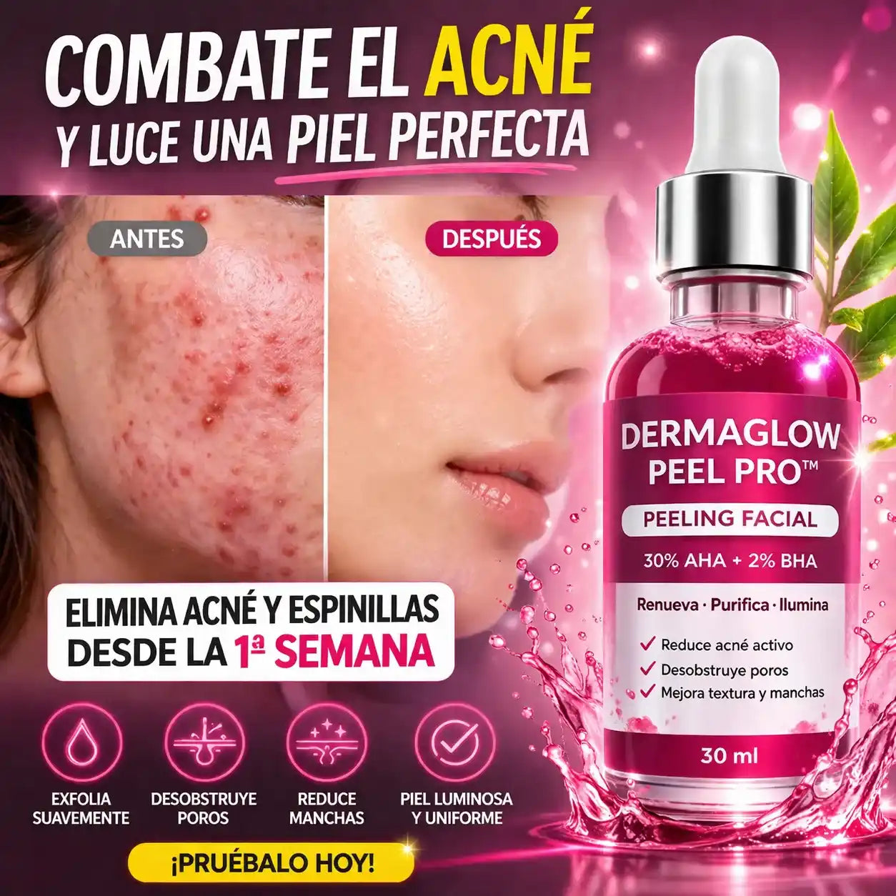 DermaGlow Peel Pro™ – Exfoliación Profunda para Eliminar Acné, Puntos Negros y Manchas