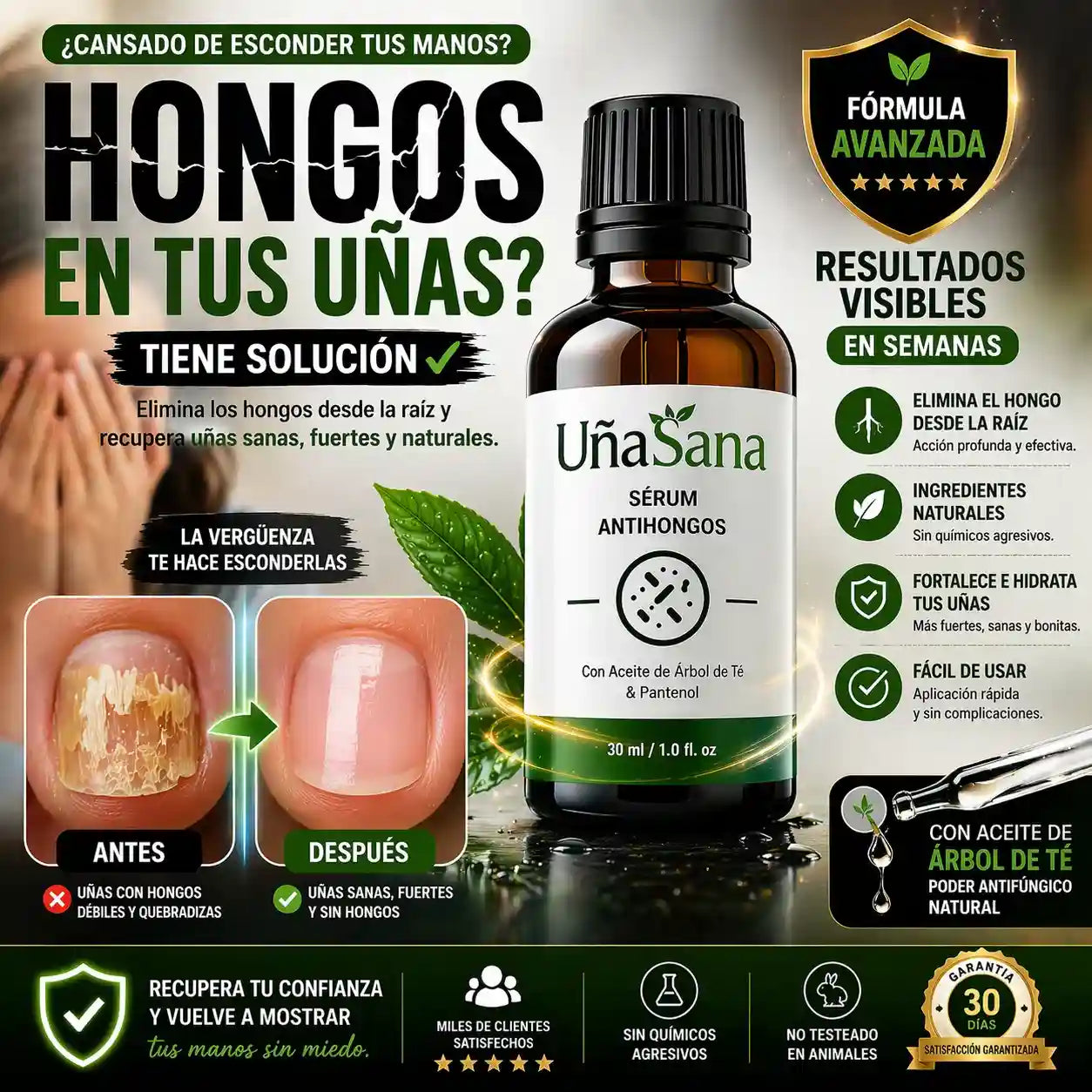 Serum Antihongos 30ML -Vuelve a mostrar tus uñas sin vergüenza