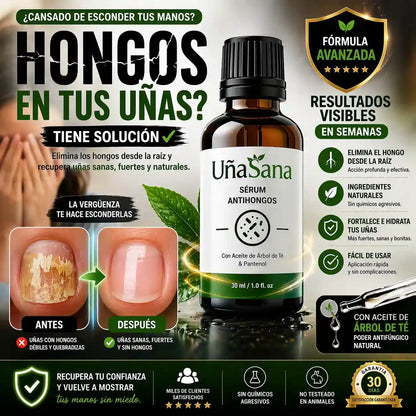 Serum Antihongos 30ML -Vuelve a mostrar tus uñas sin vergüenza