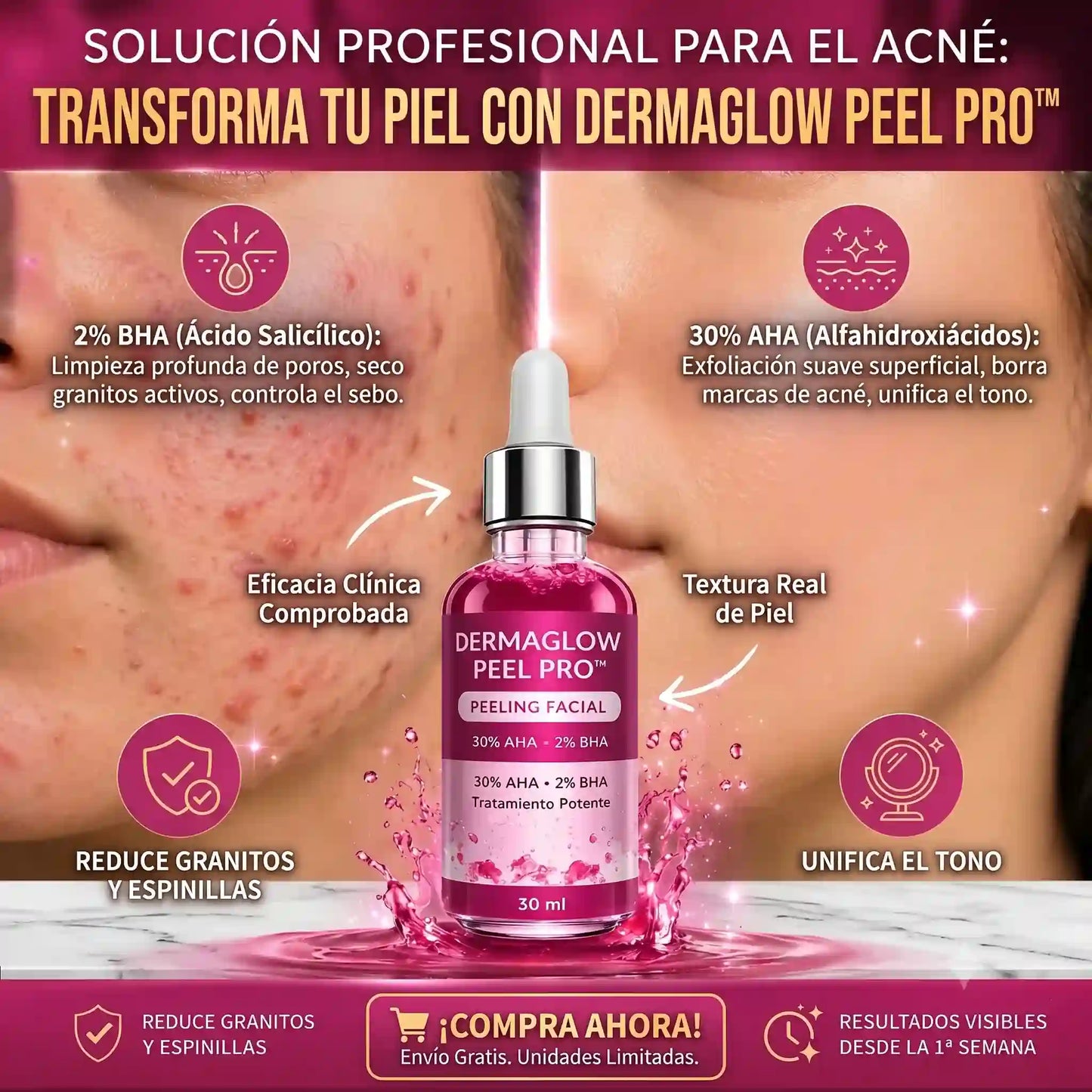 DermaGlow Peel Pro™ – Exfoliación Profunda para Eliminar Acné, Puntos Negros y Manchas