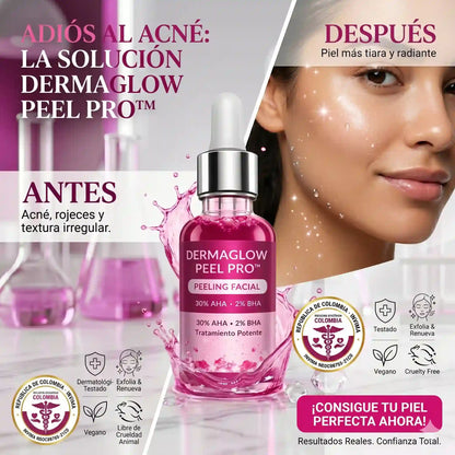 DermaGlow Peel Pro™ – Exfoliación Profunda para Eliminar Acné, Puntos Negros y Manchas