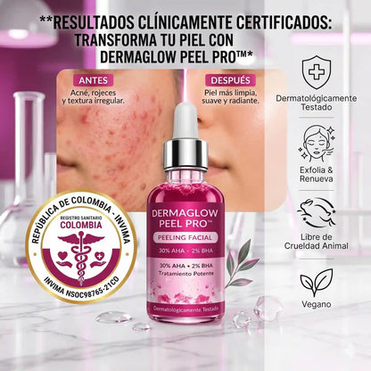 DermaGlow Peel Pro™ – Exfoliación Profunda para Eliminar Acné, Puntos Negros y Manchas