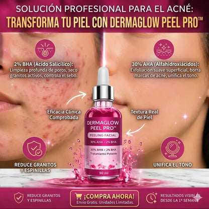 DermaGlow Peel Pro™ – Exfoliación Profunda para Eliminar Acné, Puntos Negros y Manchas