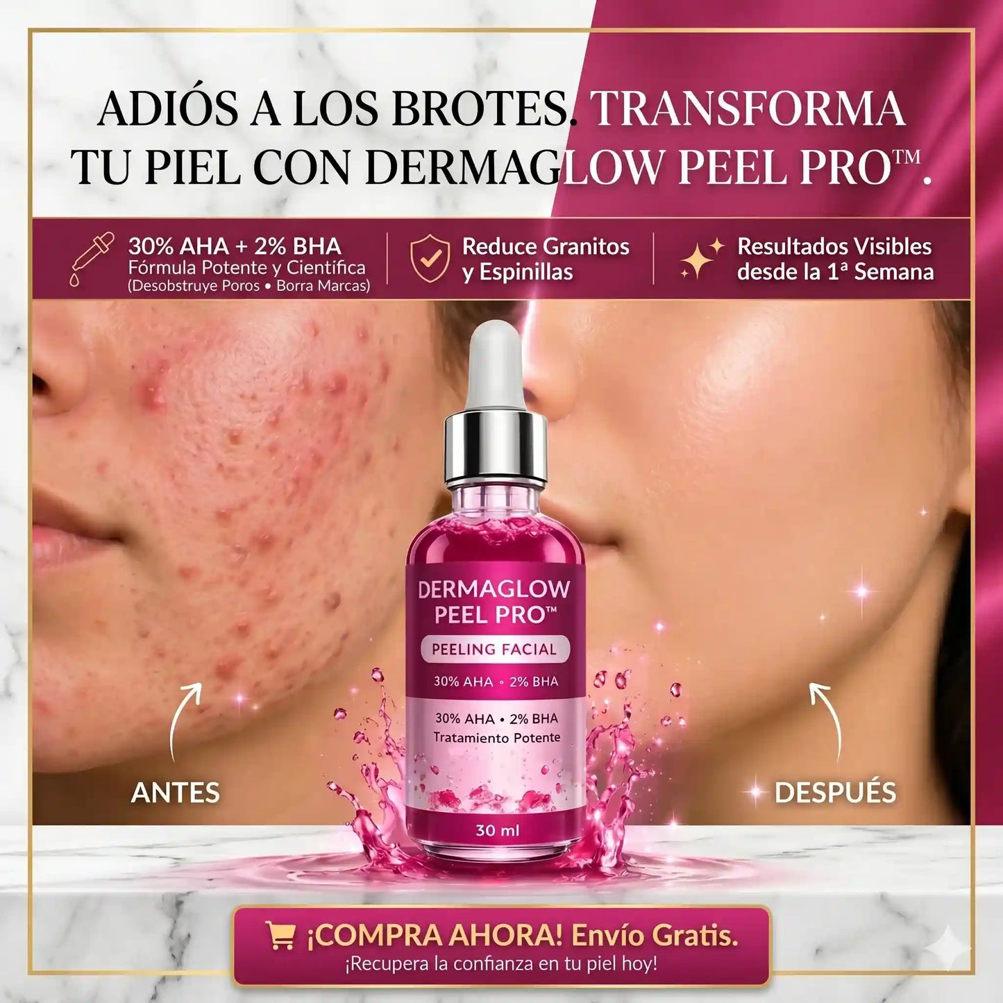 DermaGlow Peel Pro™ – Exfoliación Profunda para Eliminar Acné, Puntos Negros y Manchas