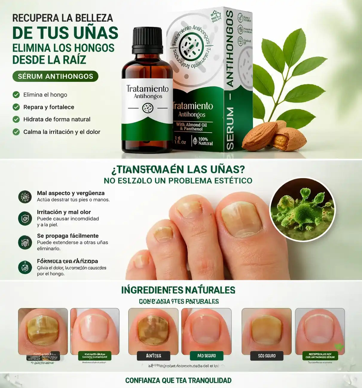 Serum Antihongos 30ML -Vuelve a mostrar tus uñas sin vergüenza