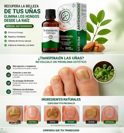 Serum Antihongos 30ML -Vuelve a mostrar tus uñas sin vergüenza