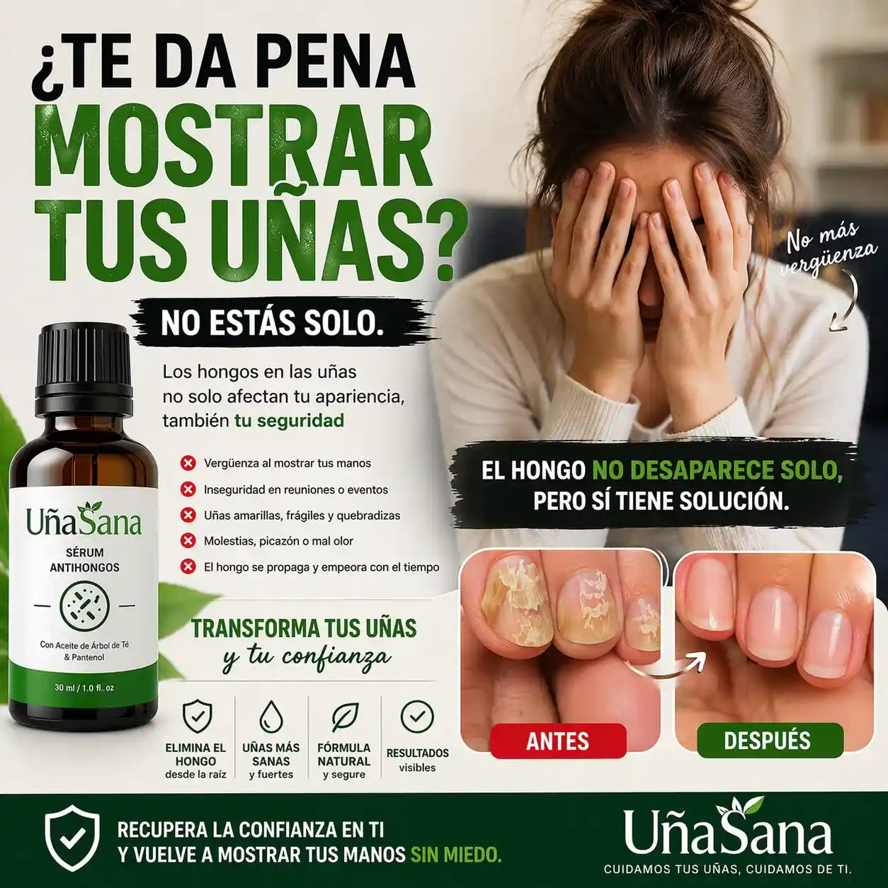 Serum Antihongos 30ML -Vuelve a mostrar tus uñas sin vergüenza