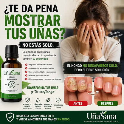 Serum Antihongos 30ML -Vuelve a mostrar tus uñas sin vergüenza