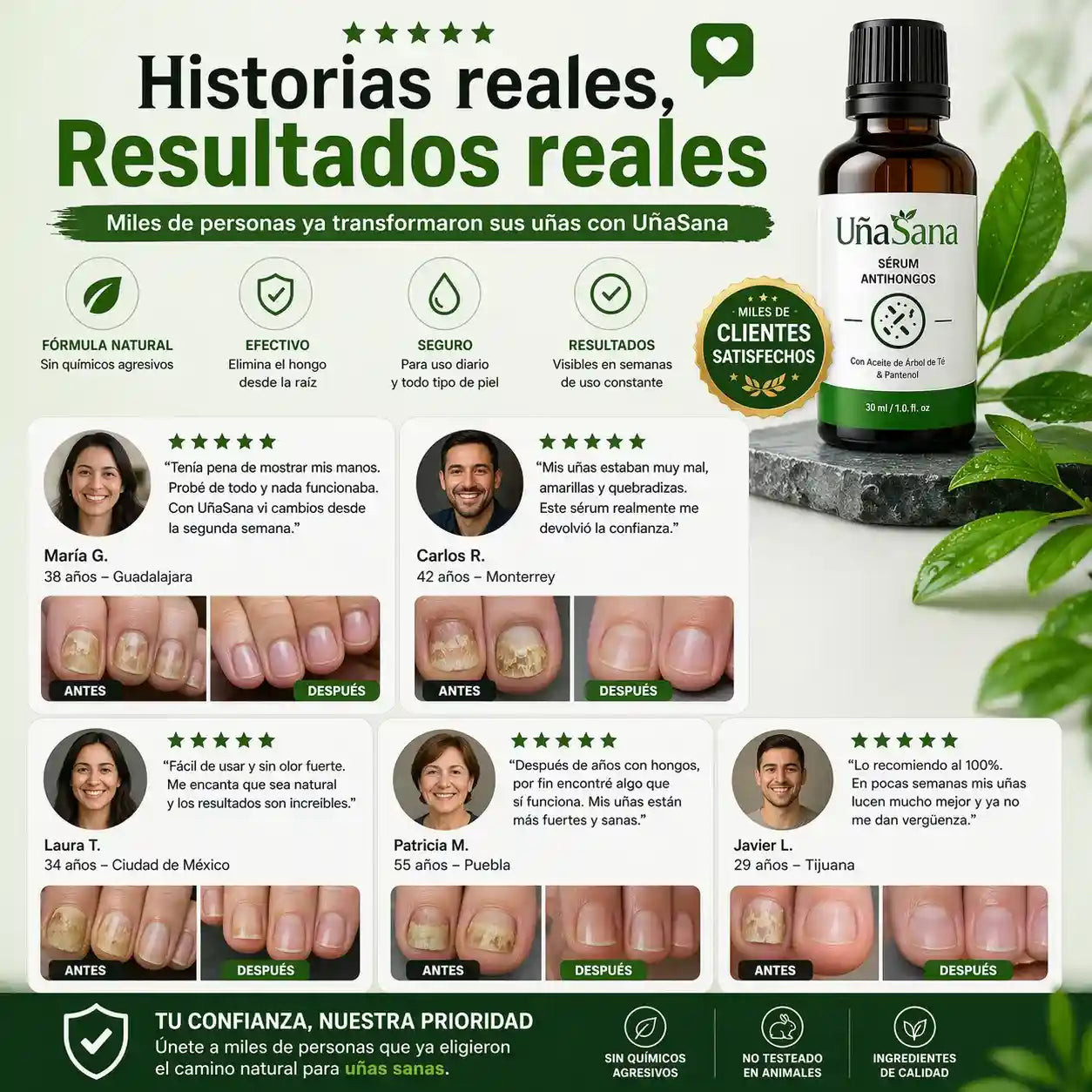 Serum Antihongos 30ML -Vuelve a mostrar tus uñas sin vergüenza