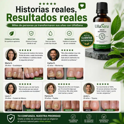 Serum Antihongos 30ML -Vuelve a mostrar tus uñas sin vergüenza