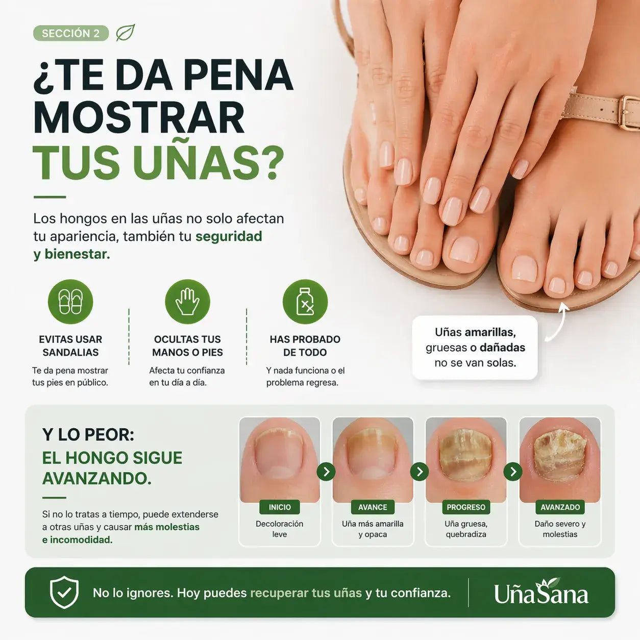 Serum Antihongos 30ML -Vuelve a mostrar tus uñas sin vergüenza