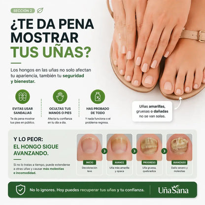 Serum Antihongos 30ML -Vuelve a mostrar tus uñas sin vergüenza
